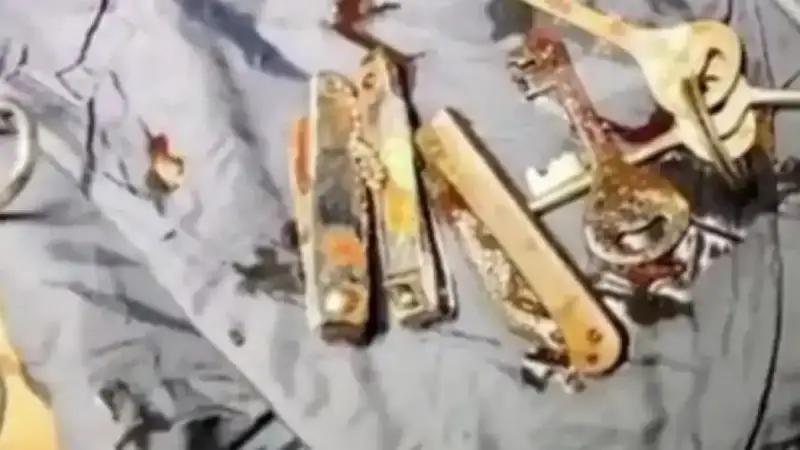 شاب هندي يبتلع مفاتيح وسكينًا