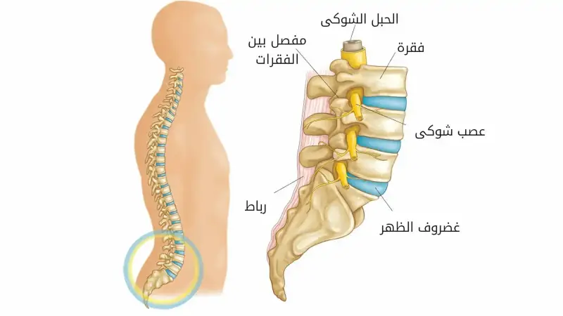 الإنزلاق الغضروفي