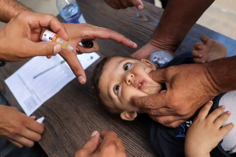 تطعيم شلل الأطفال