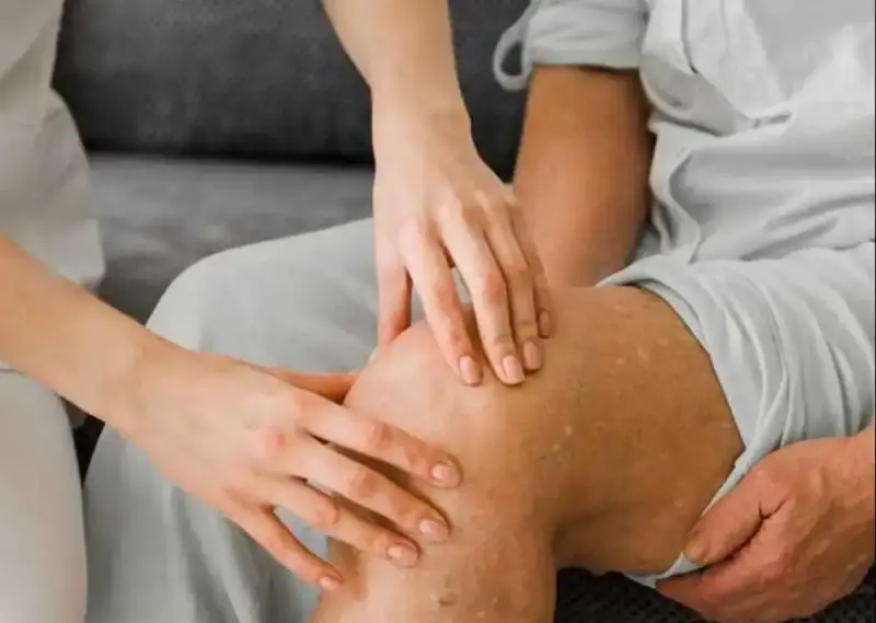 متلازمه فيكساس في مصر