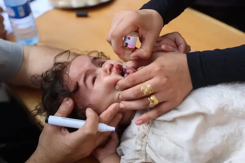 حملة التطعيم ضد شلل الأطفال