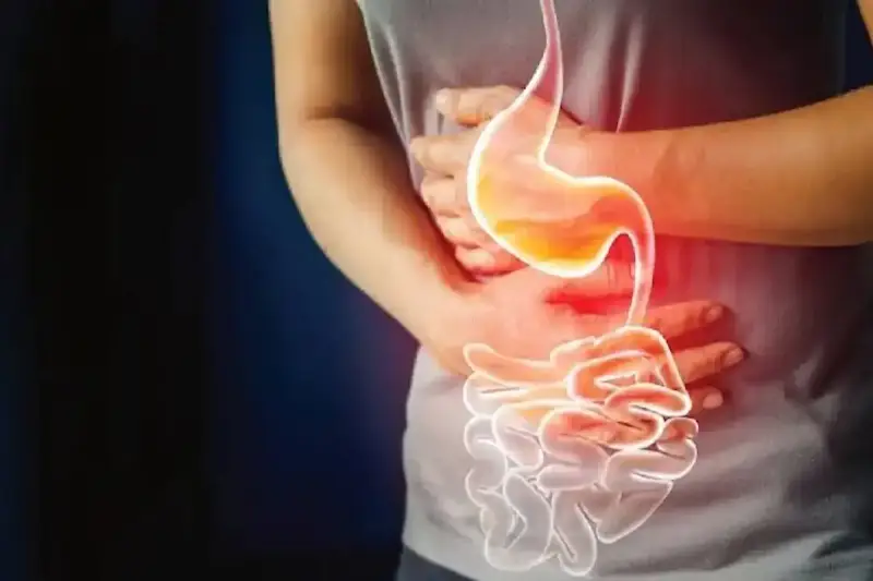 حقيقة منع مرضى القولون التقرحي من الصيام