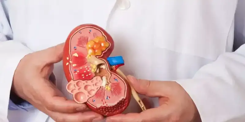 عادات يومية للحفاظ على صحة الكلى