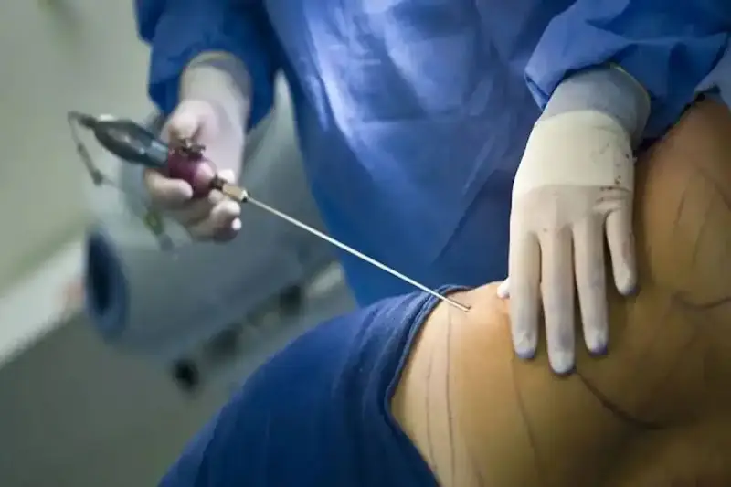 حبس طبيب تجميل جزائري شهير.. عملية فاشلة تهز الجزائر