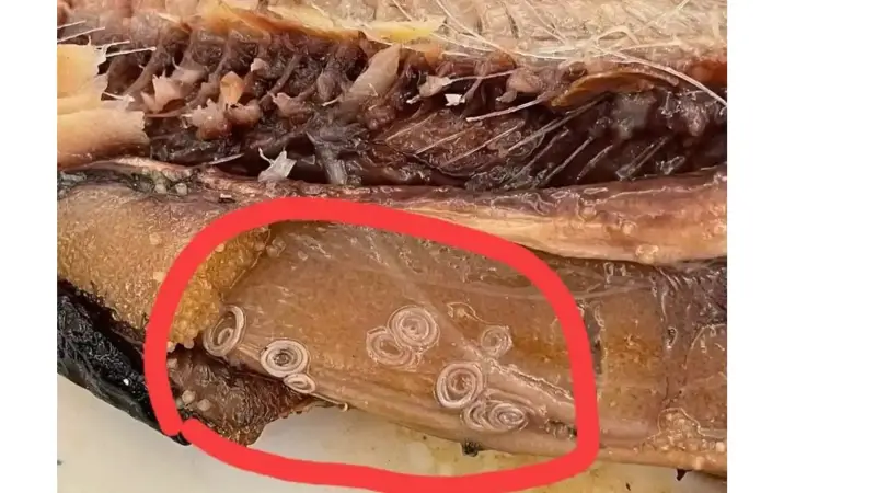 دودة الأنيساكس في أسماك الرنجة