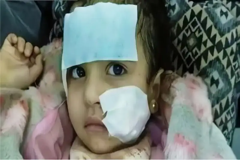 طفلة هجوم شبل الأسد