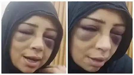 سبب اعتداء خطيب على خطيبته السابقة