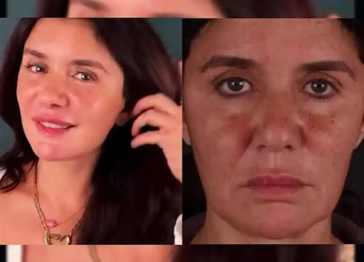 تفاصيل عملية تجميل غادة عادل